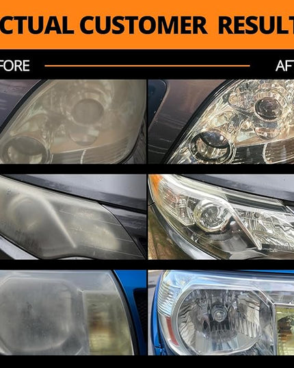 CERAKOTE® Ceramic Headlight Restoration Kit – Guaranteed To Last As Long As You Own Your Vehicle – Brings Headlights Back to Like New Condition - No Power Tools Required - 10 Wipe Kit