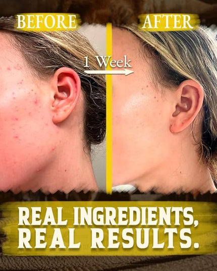 Organic Beef Tallow for Skin - 4 OZ (Citrus) — Grass Fed Beef Tallow for face + Body — US-Made Whipped Tallow and Honey Balm Moisturizer for Dry and Sensitive Skin, Eczema, Rosacea (No Additives)