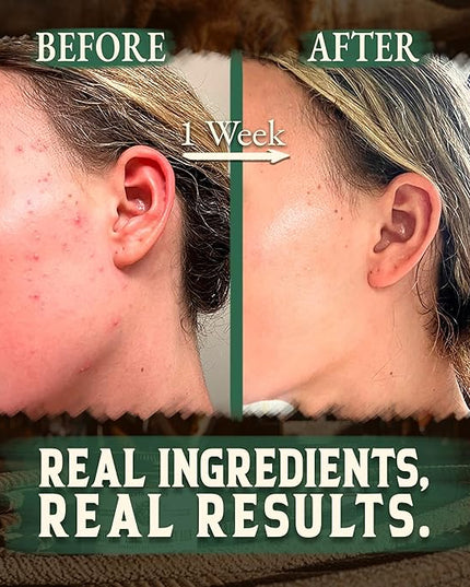 Organic Beef Tallow for Skin - 4 OZ (Eucalyptus) — Grass Fed Beef Tallow for face + Body — US-Made Whipped Tallow and Honey Balm Moisturizer for Dry and Sensitive Skin, Eczema, Rosacea (No Additives)