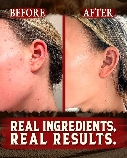 Organic Beef Tallow for Skin - 4 OZ (Vanilla) — Grass Fed Beef Tallow for face + Body — US-Made Whipped Tallow and Honey Balm Moisturizer for Dry and Sensitive Skin, Eczema, Rosacea (No Additives)
